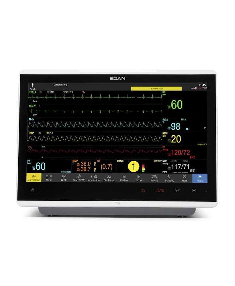 EDAN iX Series Patient Monitor