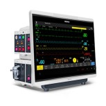 Patient Monitoring